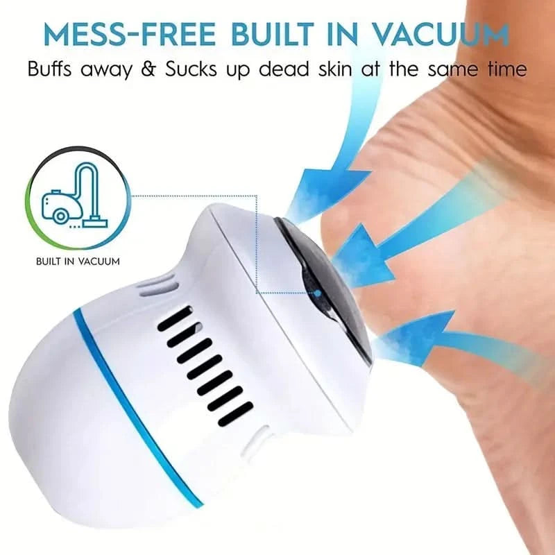 Meuleuse de Pieds Électrique pour des Talons Doux et Lisses